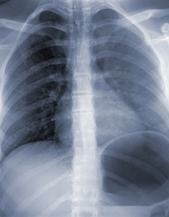 Spine