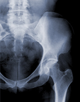 Hip