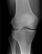 Sports Medicine